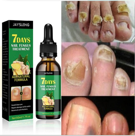 💅🌿 Aceite de Jengibre para Cuidado y Reparación de Uñas X2 Unidades