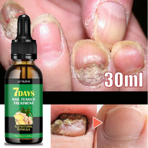 💅🌿 Aceite de Jengibre para Cuidado y Reparación de Uñas X2 Unidades