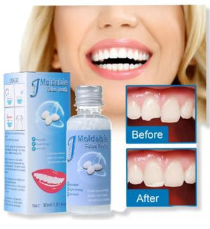 Resina Moldeadora Dental Temporal 30 ml 🦷✨