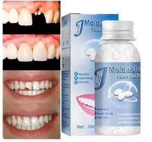 Resina Moldeadora Dental Temporal 30 ml 🦷✨